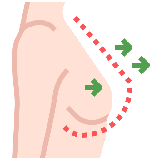Breast Augmentation